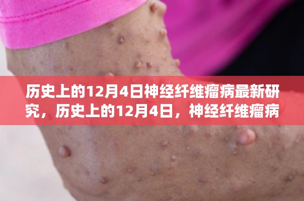 歷史上的神經(jīng)纖維瘤病研究之旅，與自然美景共舞，探尋內(nèi)心寧?kù)o港灣的新突破