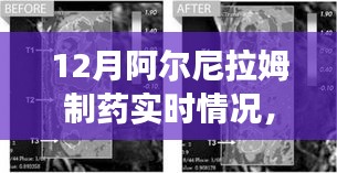 阿爾尼拉姆制藥12月實時動態(tài)，生產(chǎn)進(jìn)展、市場洞察一覽無余